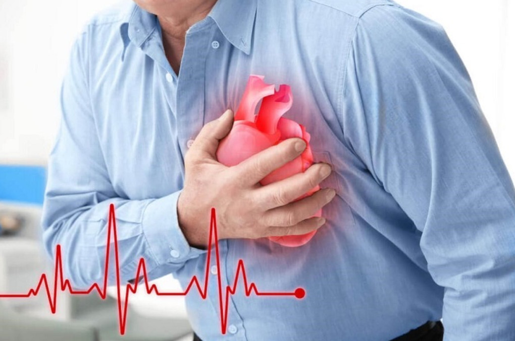 91-1 Suy tim giai đoạn cuối đe dọa tính mạng của người bệnh