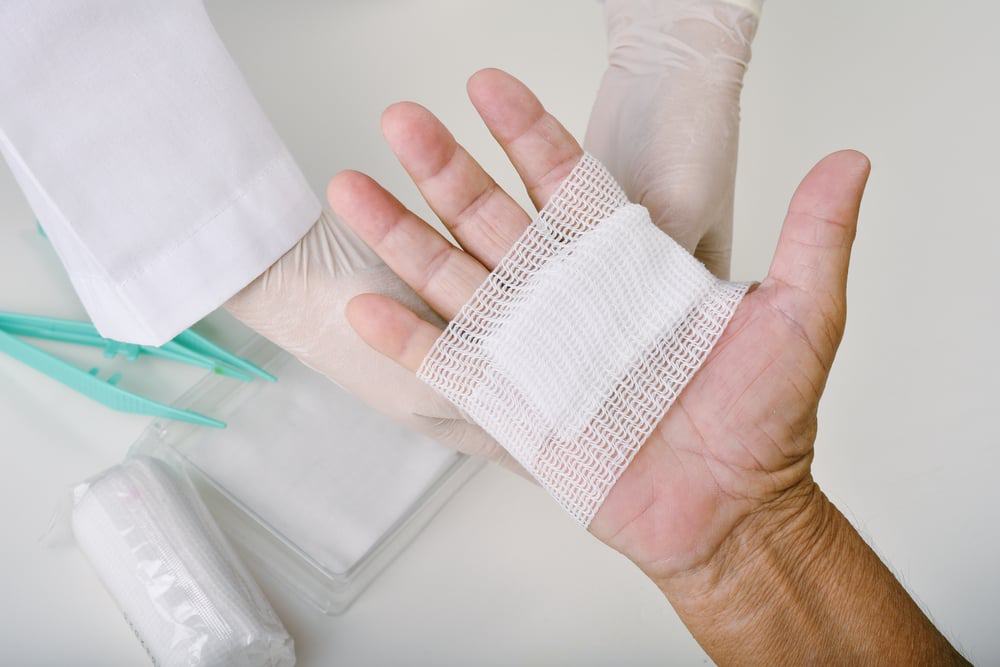 cắt chỉ có đau không và mẹo giảm đau