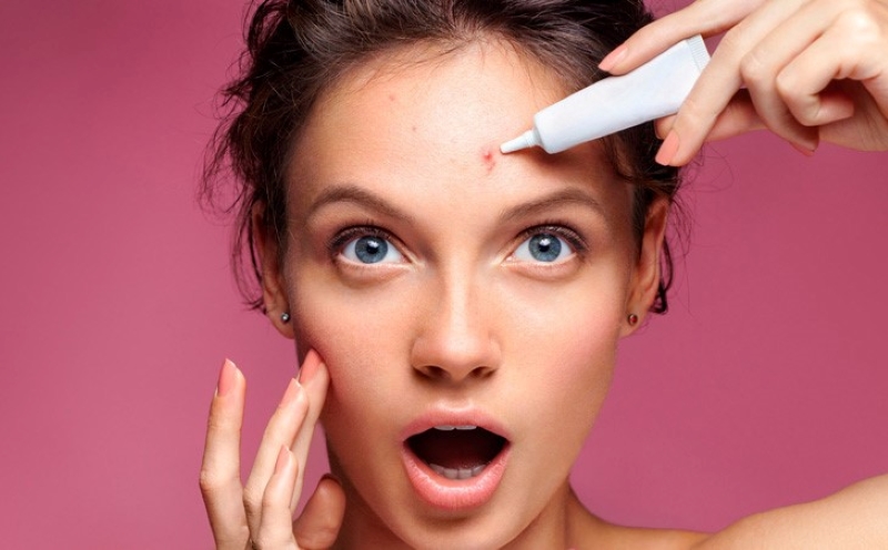 Kem trị mụn được sử dụng hiệu quả trong việc điều trị mụn
