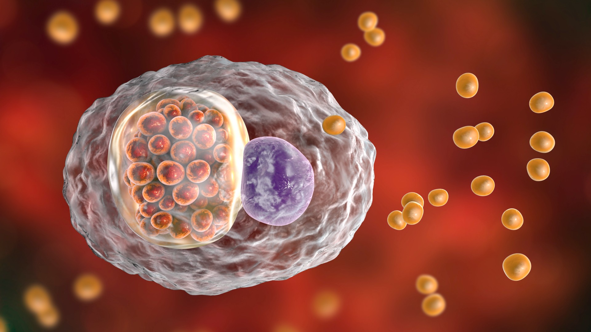 daumathot1 Đau mắt hột gây ra bởi vi khuẩn Chlamydia trachomatis