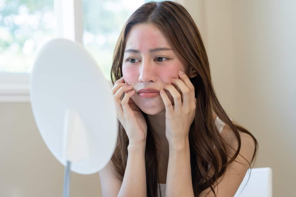 Dị ứng mỹ phẩm có tự hết không? Mẹo sử dụng mỹ phẩm không dị ứng