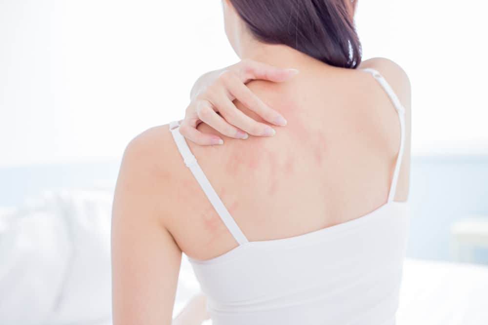 Dị ứng nước biển gây triệu chứng gì? Cách điều trị, phòng ngừa hiệu quả