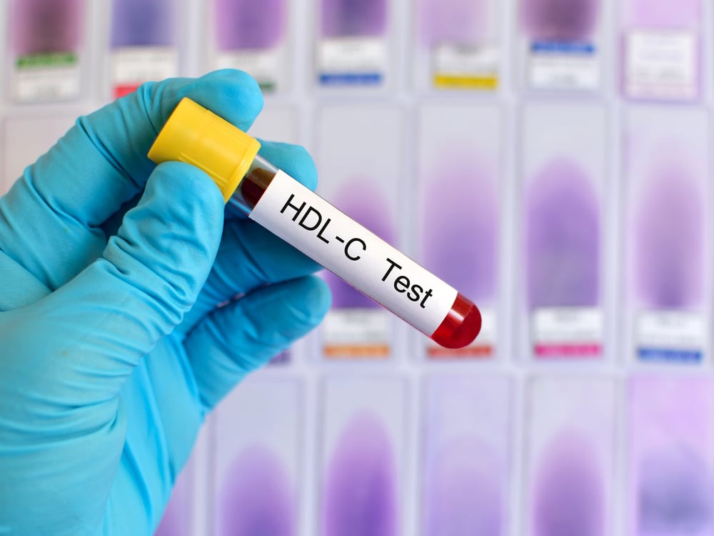Xét nghiệm định lượng HDL-C là gì? Khi nào thực hiện và quy trình ra sao?