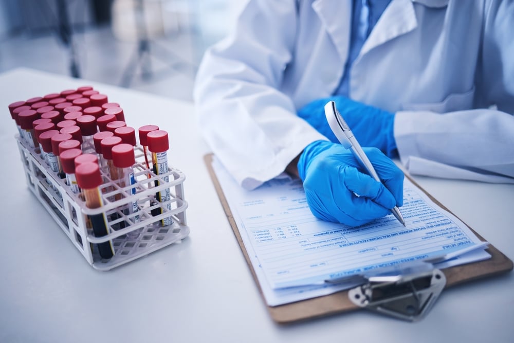 doc-ket-qua-mcv-trong-xet-nghiem-mau đọc kết quả MCV trong xét nghiệm máu là gì