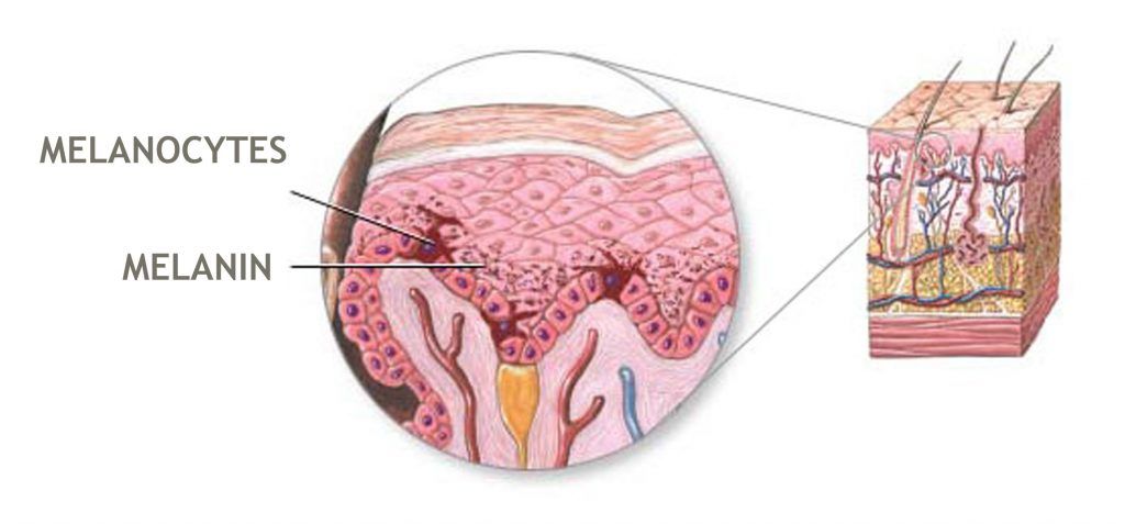 dom-2 Nám da, tàn nhang và đồi mồi xuất hiện do sự sản sinh không đồng đều của melanin trên da