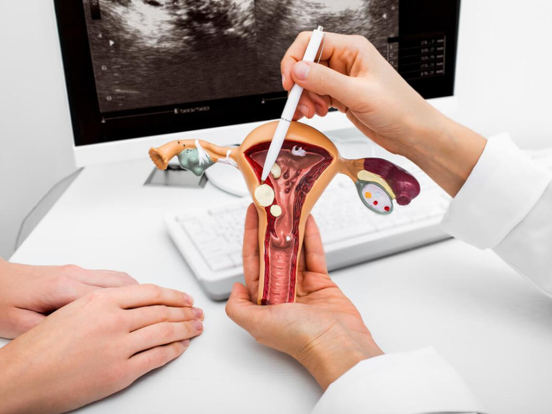 Ung thư cổ tử cung giai đoạn 1 sống được bao lâu phụ thuộc vào một số yếu tố