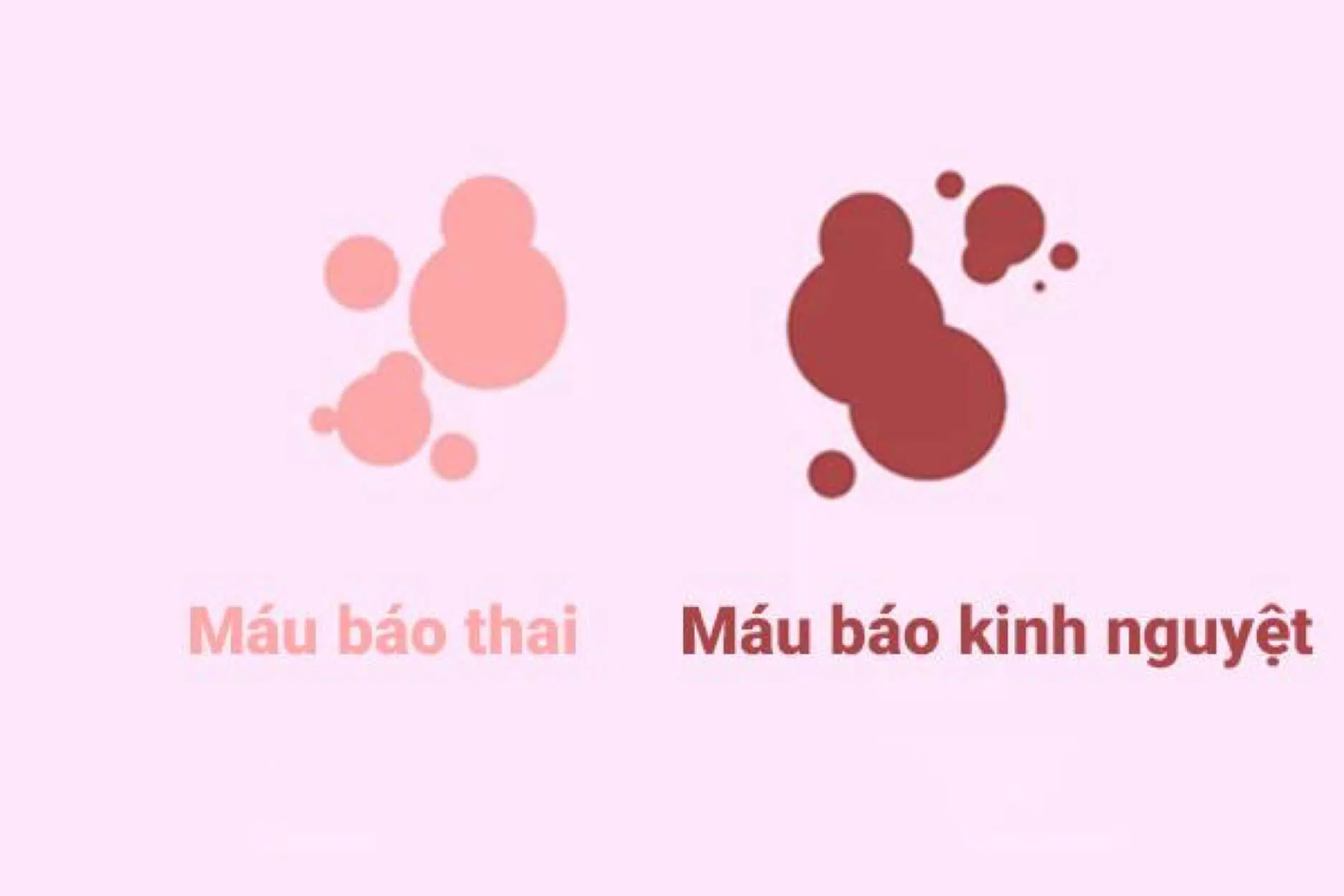 mau-bao-thai-la-cach-nhan-biet-co-thai-som-nhat Dựa vào máu báo thai để biết mình có thai hay không?