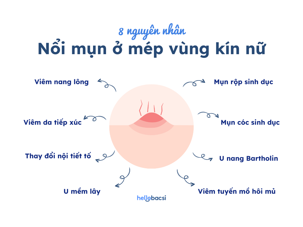 nguyen-nhan-noi-mun-o-mep-vung-kin-nu Nguyên nhân nổi mụn ở mép vùng kín nữ