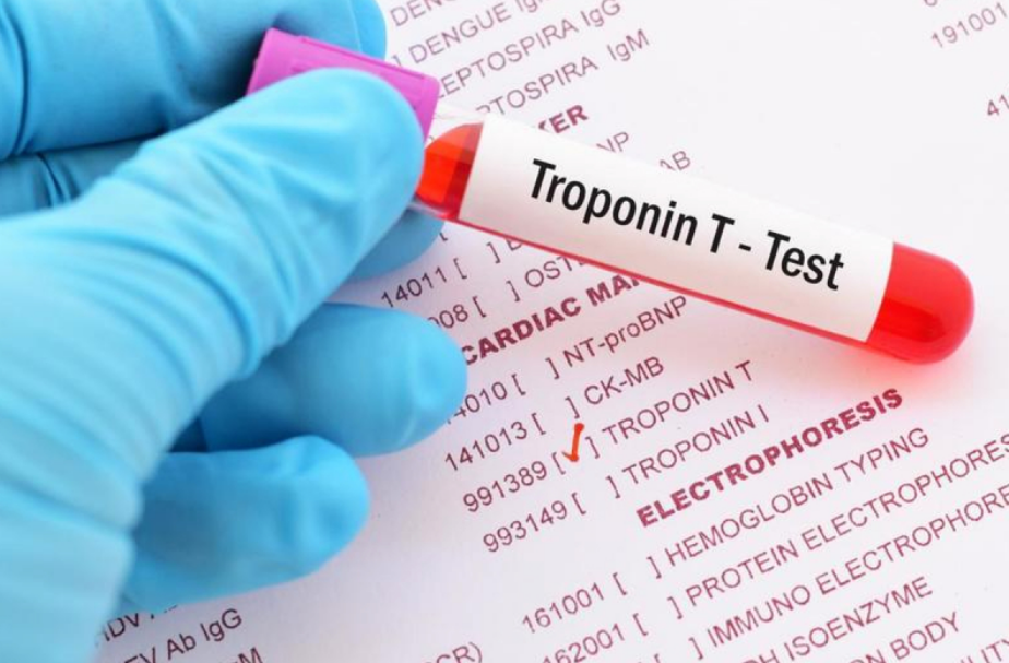 nmct-1-1 Xét nghiệm nhồi máu cơ tim: Troponin T - Test
