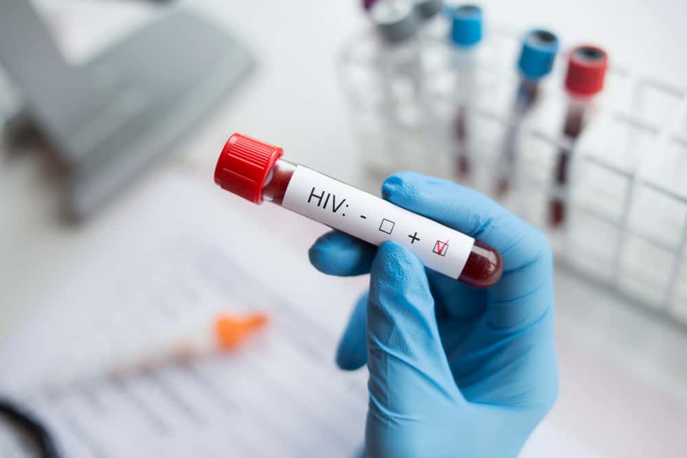 noi-hach-o-co-lau-ngay-khong-dau-do-hiv nổi hạch ở cổ lâu ngày không đau do HIV