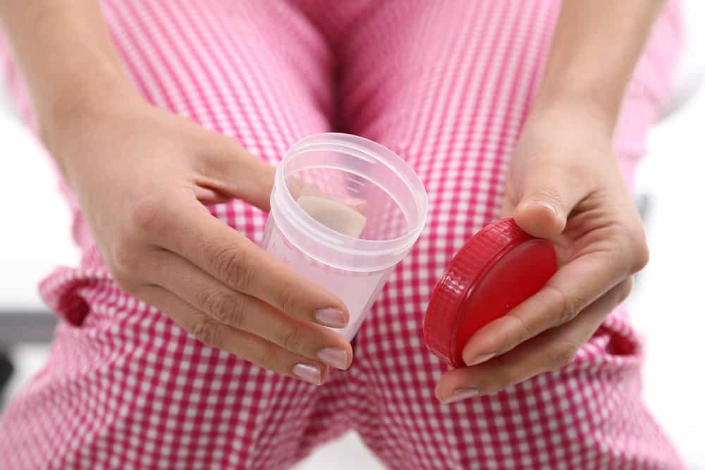 nuoc-tieu-co-vang-do-lipid Nước tiểu có váng do lipid