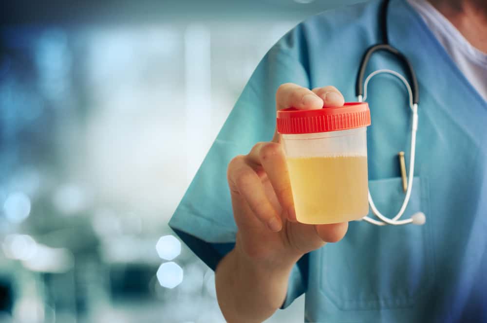 Giải đáp: Nước tiểu có váng nguyên nhân do đâu?