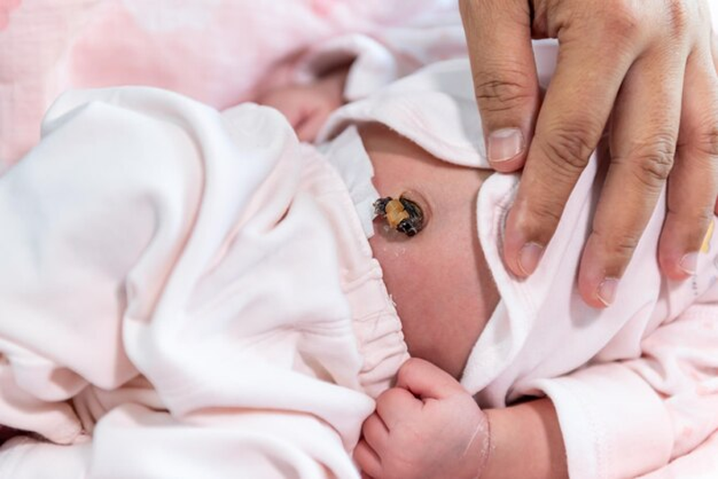 Hãy để rốn của trẻ được khô và rụng tự nhiên