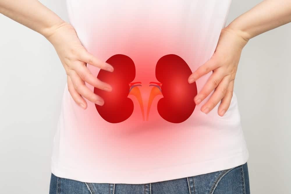 tan-soi-than-qua-da-2 tán sỏi thận qua da có nguy hiểm không