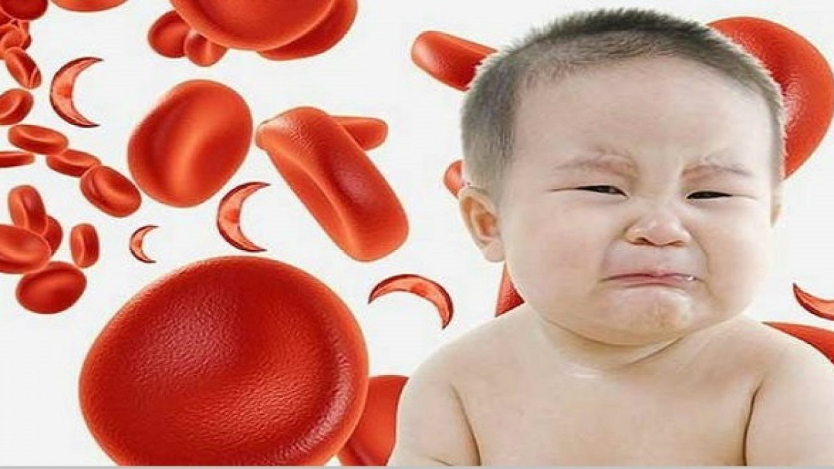 techan1 Thiếu máu có thể là nguyên nhân gây tê tay, tê chân ở trẻ em