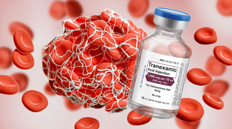 thuoc-tranexamic-acid-dang-tiem Thuốc Tranexamic Acid dạng tiêm