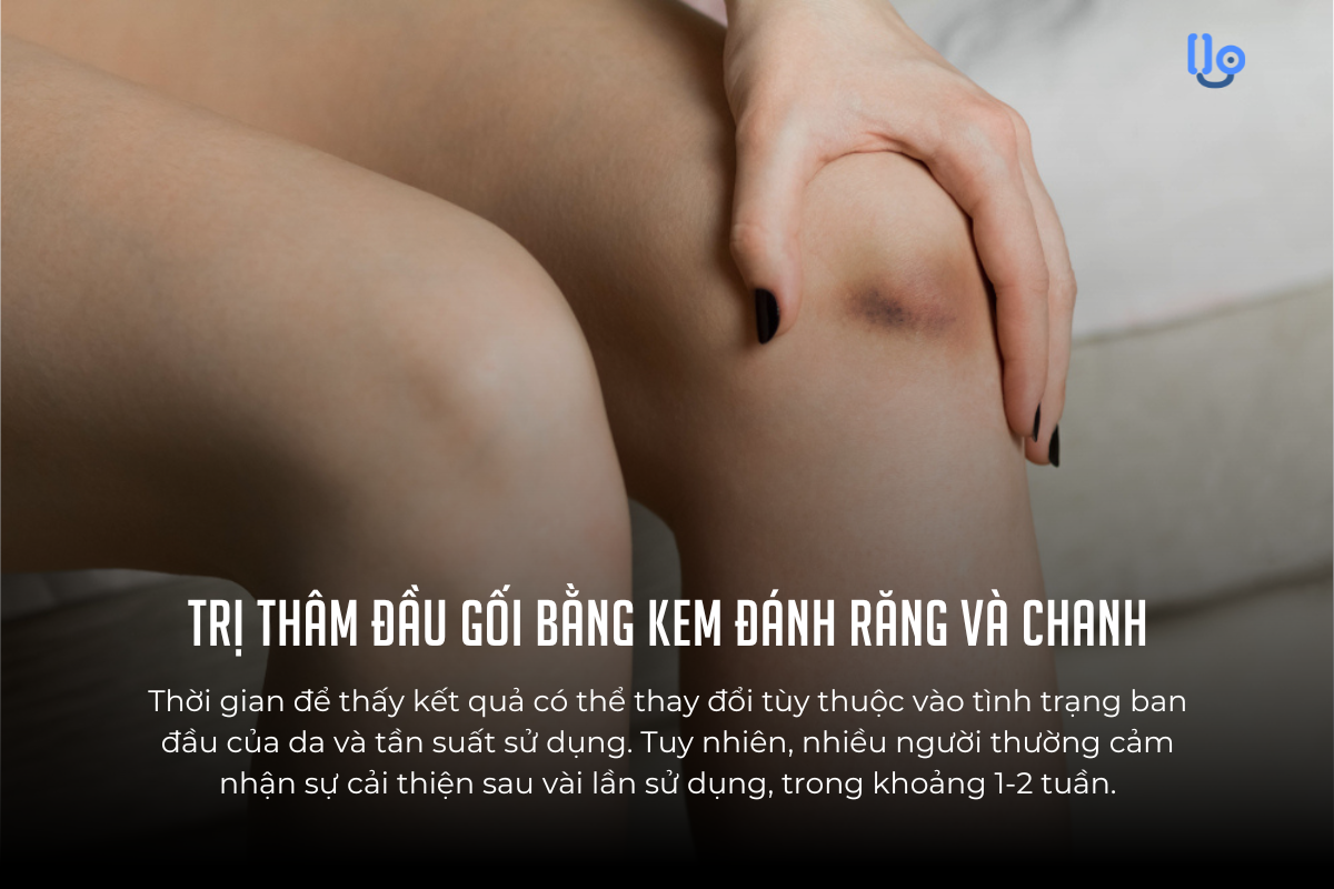 tri-tham-dau-goi-bang-kem-danh-rang-va-chanh Trị thâm đầu gối bằng kem đánh răng và chanh