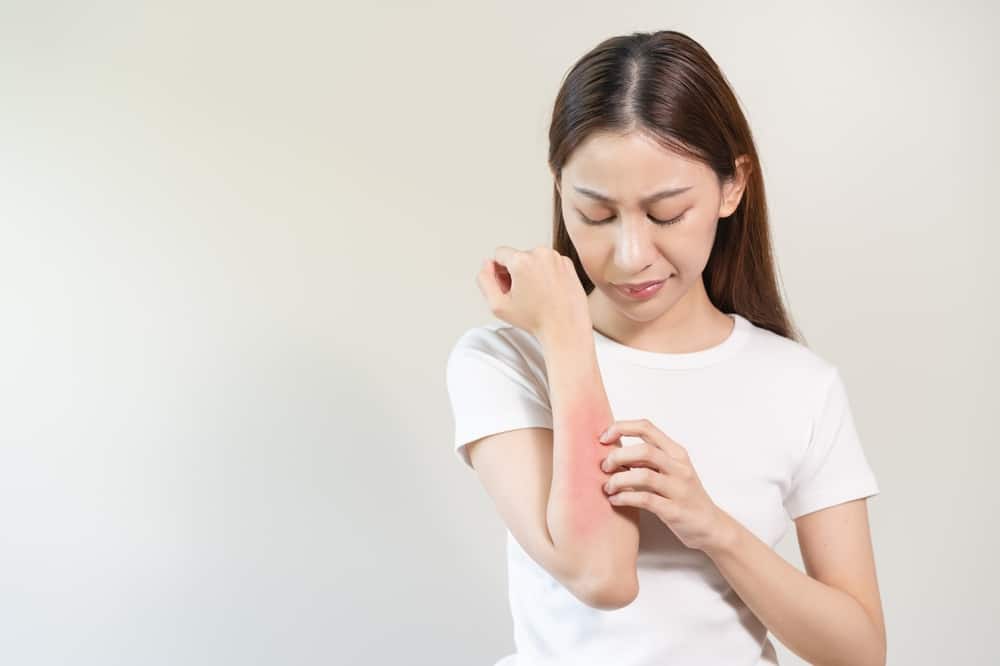 uống bia bị ngứa do không dung nạp rượu bia