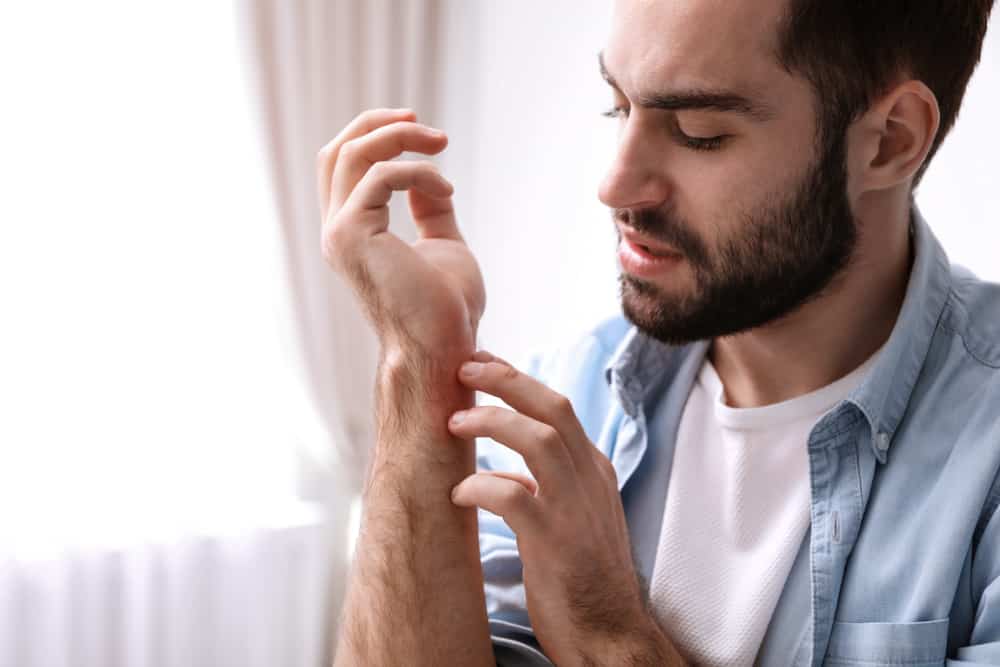 uống bia bị ngứa phải làm sao