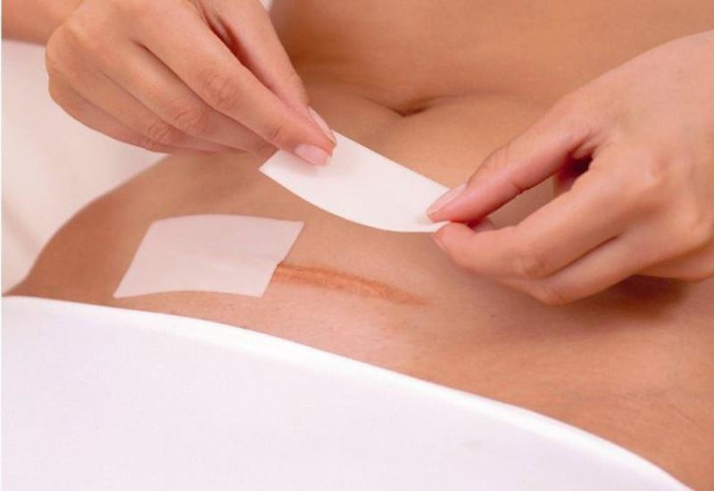 vet-mo-sau-sinh-bi-ngua-2-1 Cần giữ cho vết mổ sạch sẽ và khô thoáng