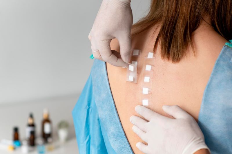 xet-nghiem-di-ung-2-1 Test phản ứng trên da để tìm kiếm dị nguyên